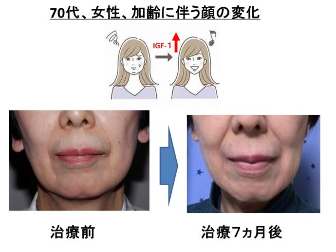 円形脱毛症　病院